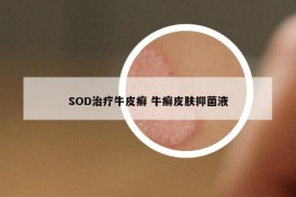 SOD治療牛皮癬 牛癬皮膚抑菌液