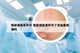 銀屑病激素懷孕 銀屑病患者懷孕了會加重病情嗎