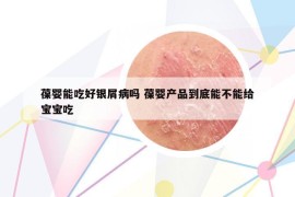 葆嬰能吃好銀屑病嗎 葆嬰產(chǎn)品到底能不能給寶寶吃