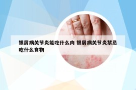 銀屑病關(guān)節(jié)炎能吃什么肉 銀屑病關(guān)節(jié)炎禁忌吃什么食物