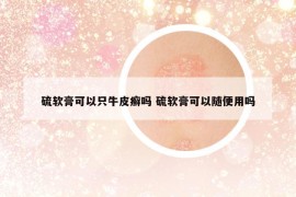 硫軟膏可以只牛皮癬嗎 硫軟膏可以隨便用嗎