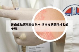 濟南皮膚醫(yī)院排名前十 濟南皮膚醫(yī)院排名前十強