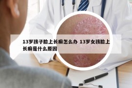 13歲孩子臉上長癬怎么辦 13歲女孩臉上長癬是什么原因