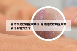 青島市皮膚病醫(yī)院如何 青島的皮膚病醫(yī)院搬到什么地方去了