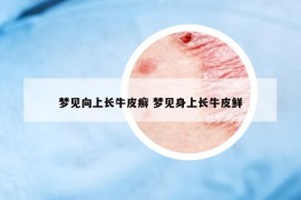 夢見向上長牛皮癬 夢見身上長牛皮鮮