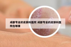 成都專業(yè)的皮膚科醫(yī)院 成都專業(yè)的皮膚科醫(yī)院在哪里