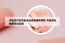 河北生產(chǎn)的萬能膏治皮膚病好使嗎 萬能膏在哪里可以買到