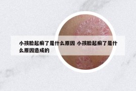 小孩臉起癬了是什么原因 小孩臉起癬了是什么原因造成的