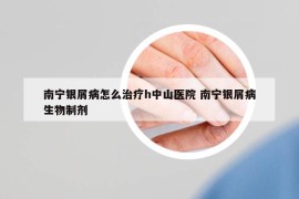 南寧銀屑病怎么治療h中山醫(yī)院 南寧銀屑病生物制劑