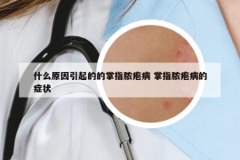 什么原因引起的的掌指膿皰病 掌指膿皰病的癥狀