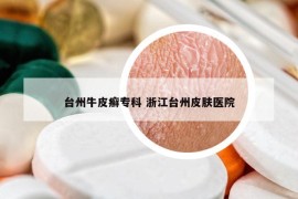 臺州牛皮癬?？?浙江臺州皮膚醫(yī)院
