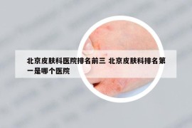 北京皮膚科醫(yī)院排名前三 北京皮膚科排名第一是哪個醫(yī)院