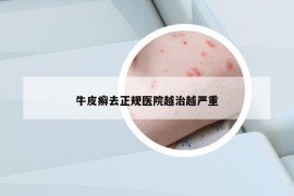 牛皮癬去正規(guī)醫(yī)院越治越嚴(yán)重