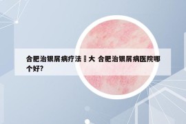 合肥治銀屑病療法軍大 合肥治銀屑病醫(yī)院哪個(gè)好?