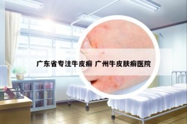 廣東省專注牛皮癬 廣州牛皮膚癬醫(yī)院