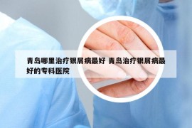 青島哪里治療銀屑病最好 青島治療銀屑病最好的專科醫(yī)院