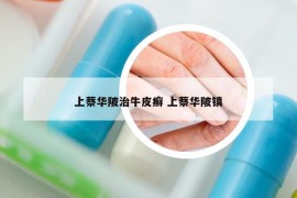 上蔡華陂治牛皮癬 上蔡華陂鎮(zhèn)