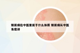 銀屑病在中醫(yī)里屬于什么體質(zhì) 銀屑病從中醫(yī)角度講