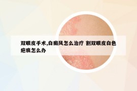 雙眼皮手術(shù),白癜風(fēng)怎么治療 割雙眼皮白色疤痕怎么辦