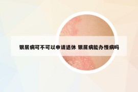 銀屑病可不可以申請(qǐng)退休 銀屑病能辦慢病嗎