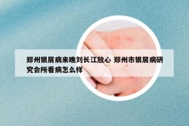 鄭州銀屑病來(lái)瞧劉長(zhǎng)江放心 鄭州市銀屑病研究會(huì)所看病怎么樣