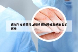 運(yùn)城牛皮癬醫(yī)院口碑好 運(yùn)城看皮膚病有名的醫(yī)院