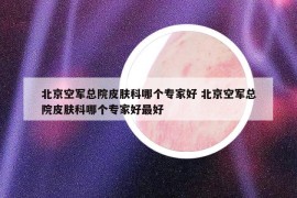 北京空軍總院皮膚科哪個專家好 北京空軍總院皮膚科哪個專家好最好