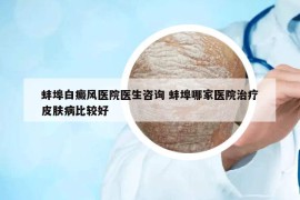 蚌埠白癜風醫(yī)院醫(yī)生咨詢 蚌埠哪家醫(yī)院治療皮膚病比較好