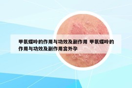 甲氨蝶呤的作用與功效及副作用 甲氨蝶呤的作用與功效及副作用宮外孕