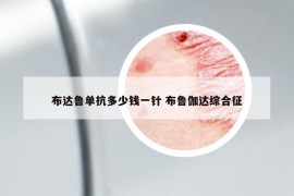 布達魯單抗多少錢一針 布魯伽達綜合征