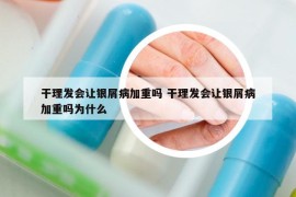 干理發(fā)會讓銀屑病加重嗎 干理發(fā)會讓銀屑病加重嗎為什么