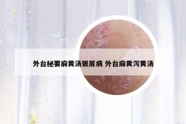 外臺秘要麻黃湯銀屑病 外臺麻黃瀉黃湯