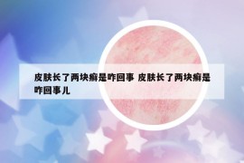 皮膚長了兩塊癬是咋回事 皮膚長了兩塊癬是咋回事兒