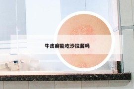 牛皮癬能吃沙拉醬嗎