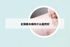 無(wú)錫看白癜風(fēng)什么醫(yī)院好
