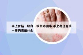 手上骨結(jié)一塊白一塊白咋回事 手上出現(xiàn)骨頭一樣的包是什么