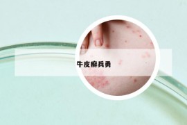 牛皮癬兵勇