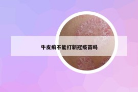 牛皮癬不能打新冠疫苗嗎