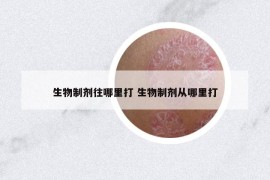 生物制劑往哪里打 生物制劑從哪里打