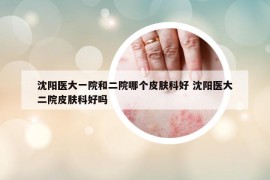 沈陽醫(yī)大一院和二院哪個皮膚科好 沈陽醫(yī)大二院皮膚科好嗎