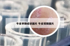 牛皮早期癥狀圖片 牛皮初期圖片