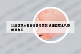 達(dá)康臣草本乳膏哪里能買到 達(dá)康臣草本乳膏哪里有買