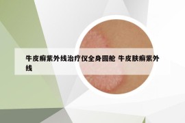 牛皮癬紫外線治療儀全身圓艙 牛皮膚癬紫外線