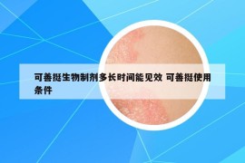 可善挺生物制劑多長時(shí)間能見效 可善挺使用條件