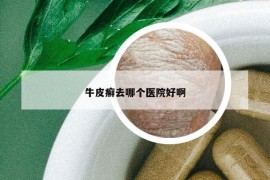牛皮癬去哪個(gè)醫(yī)院好啊
