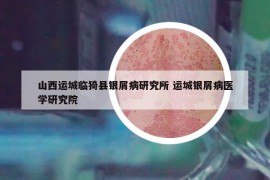 山西運城臨猗縣銀屑病研究所 運城銀屑病醫(yī)學(xué)研究院