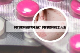 狗的銀屑病如何治療 狗的銀屑病怎么治