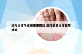洛陽治療牛皮癬正規(guī)醫(yī)院 洛陽哪里治療銀屑病好