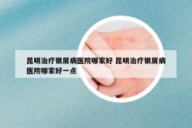 昆明治療銀屑病醫(yī)院哪家好 昆明治療銀屑病醫(yī)院哪家好一點