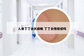 人體丁丁會長癬嘛 丁丁會得癌癥嗎